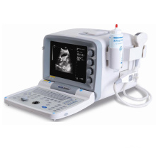 Full Digital B Mode Portable Ultrasound Machine